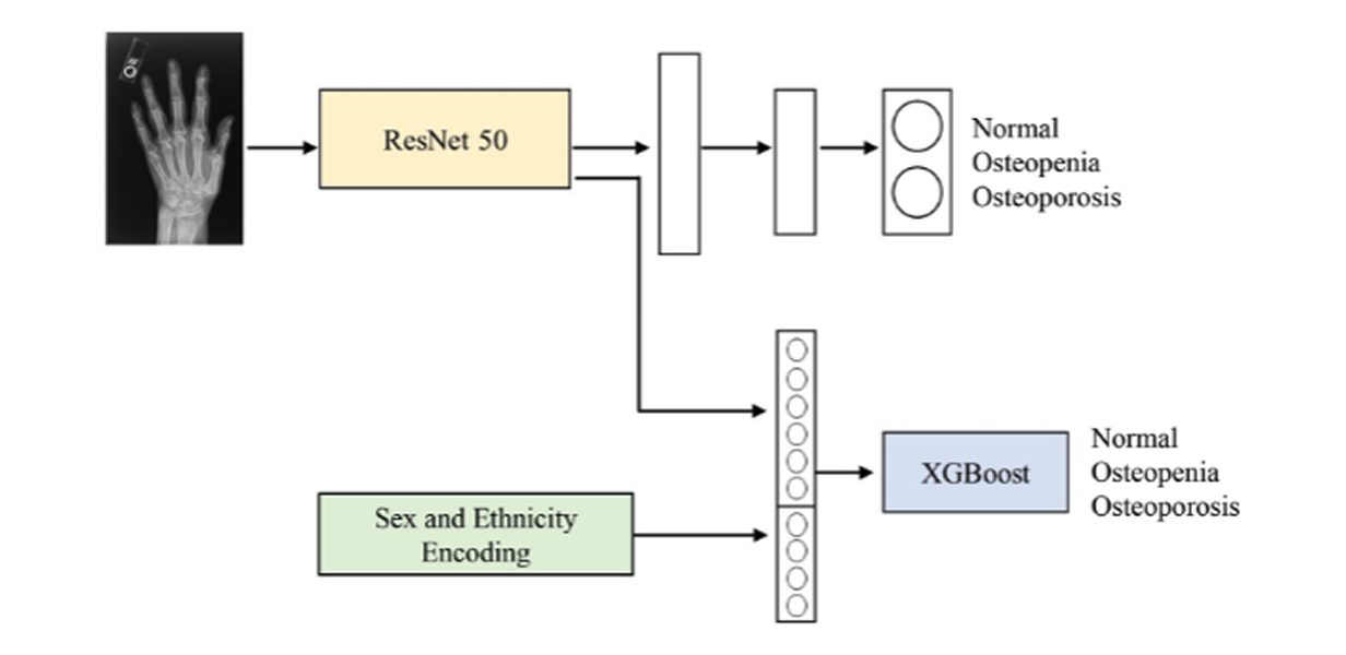 Diagram of model architecture